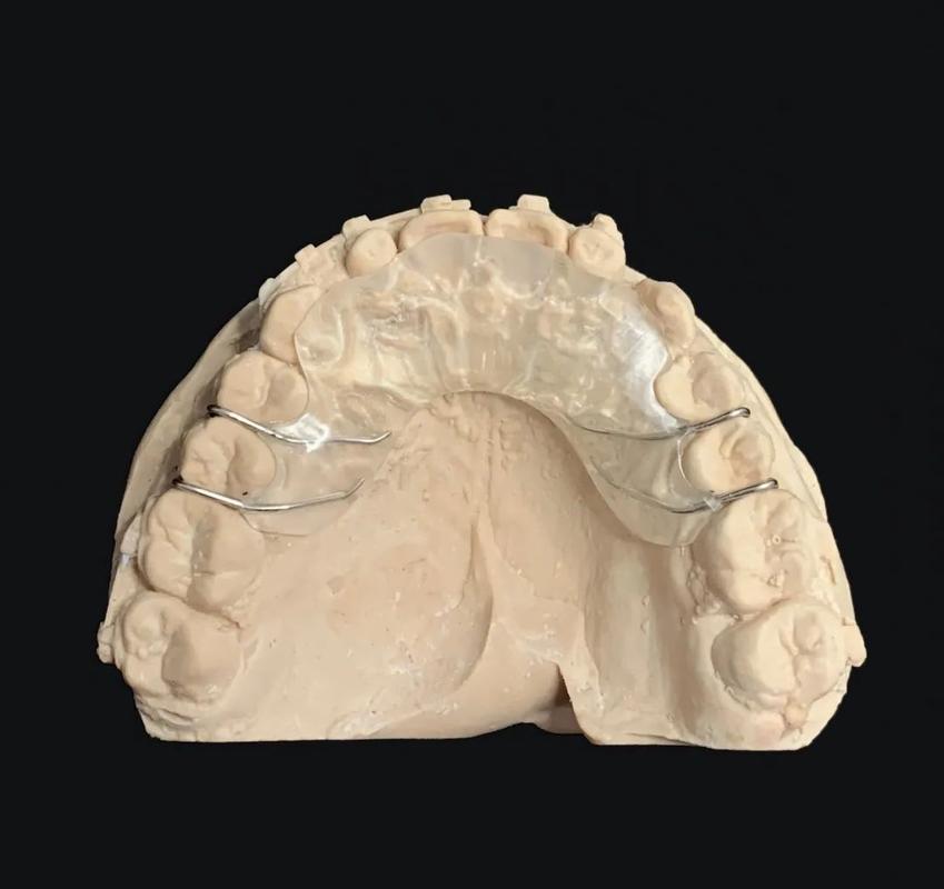 上前牙平导的制作方法详细步骤是怎样的？-图2