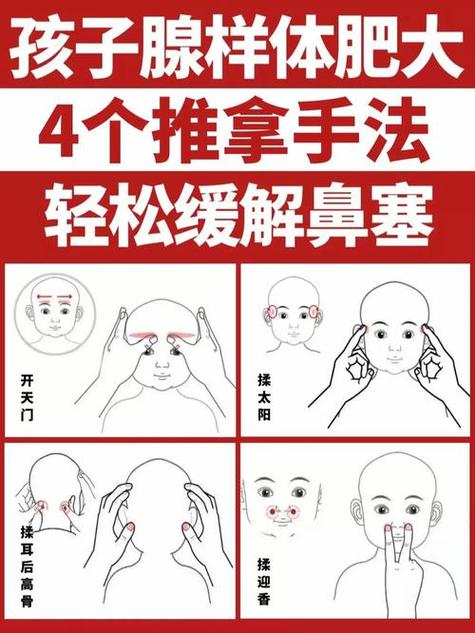 上颌后提区的制作方法应如何规范操作？关键步骤有哪些？-图2