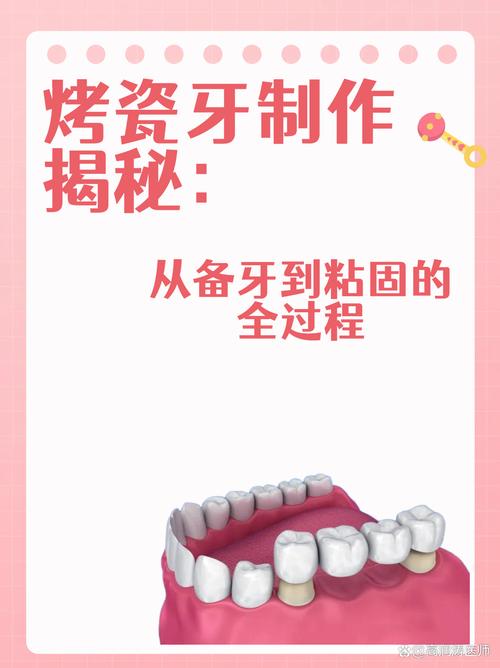 烤瓷牙制作方法图解，从备牙到戴牙的完整制作步骤图解是怎样的？-图1