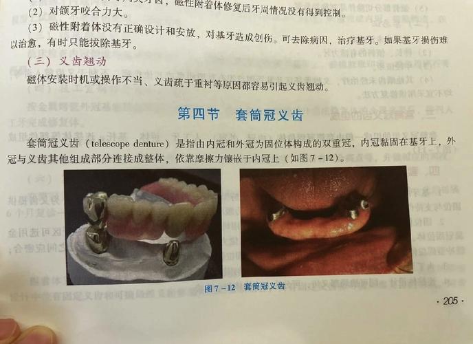 口腔用起冠器如何正确使用?步骤与方法详解-图1 口腔用起冠器如何正确使用?步骤与方法详解-图1