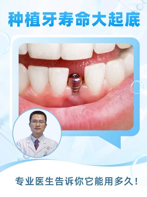 昆山弔博士种牙好不好？效果靠谱吗？-图2