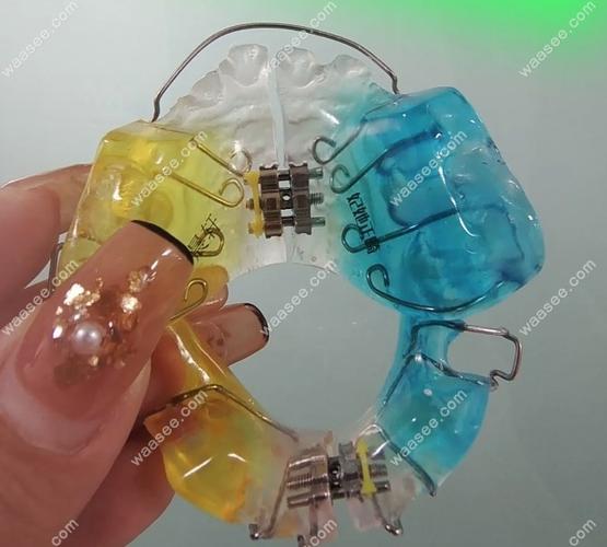 正畸sgtp双板矫治器有何独特矫治优势?-图2 正畸sgtp双板矫治器有何独特矫治优势?-图2