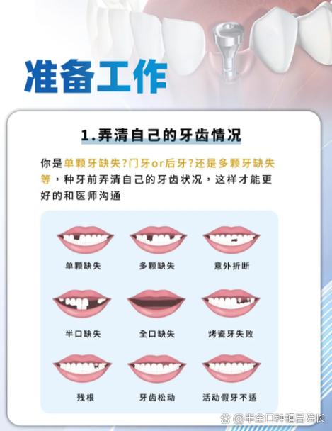 种植牙可以种黄金吗?黄金种植牙是否可行?-图1 种植牙可以种黄金吗?黄金种植牙是否可行?-图1