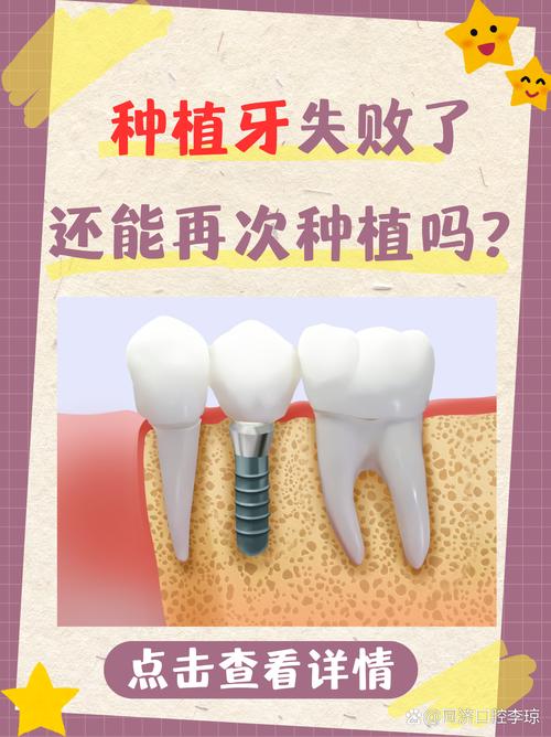 种植牙失败后还能再种吗?二次种植修复可行吗?-图1 种植牙失败后还能再种吗?二次种植修复可行吗?-图1