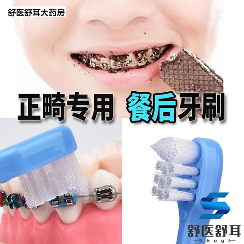 牙博士正畸费用能刷医保报销吗?-图2 牙博士正畸费用能刷医保报销吗?-图2