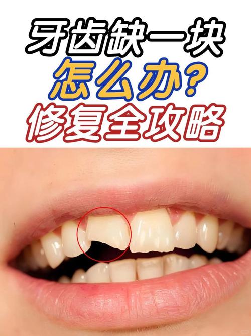 牙齿根缺损的修复方法-图2 牙齿根缺损的修复方法-图2