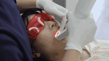 普兰梅卡口扫怎么操作？使用步骤有哪些？-图2