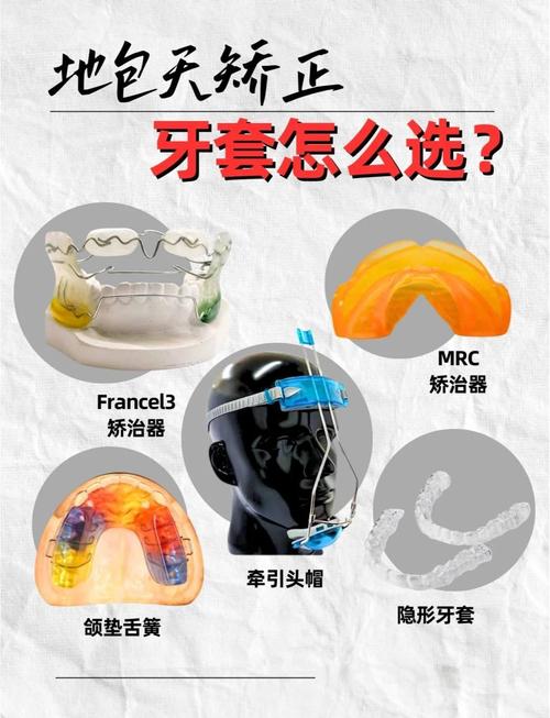 正畸地包天用哪个矫治好-图1 正畸地包天用哪个矫治好-图1