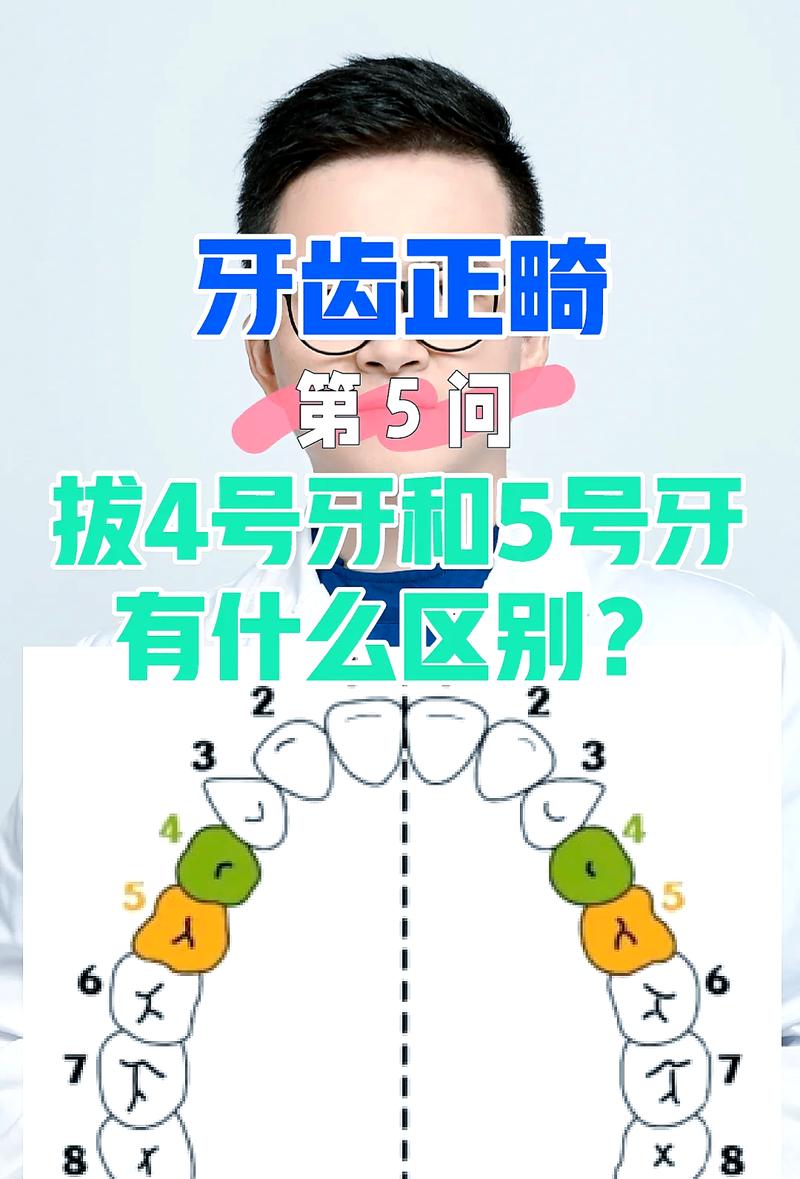 正畸拔4颗和5颗牙区别在哪?-图1 正畸拔4颗和5颗牙区别在哪?-图1