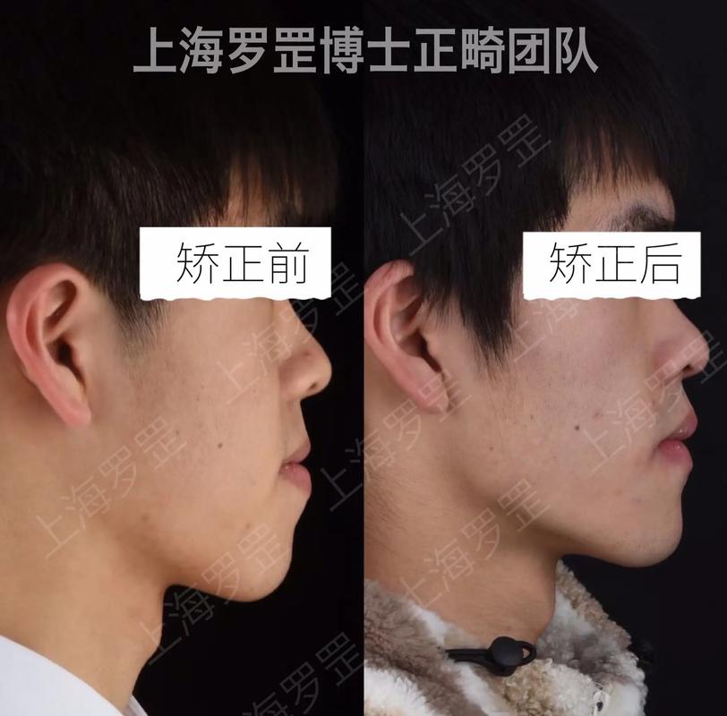 上海沈刚正畸要怎么预约-图3 上海沈刚正畸要怎么预约-图3