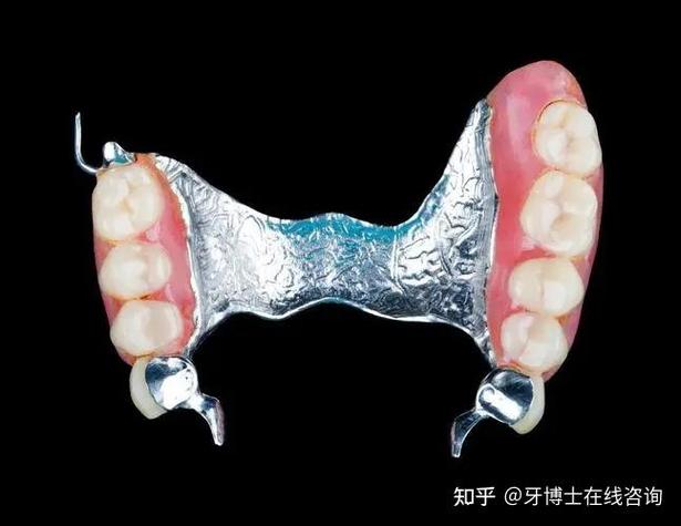 广州种牙医院怎么选？哪家靠谱又实惠？-图1