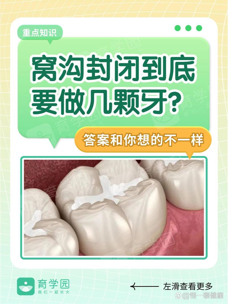 窝沟固化的方法不包括哪些具体操作？-图2