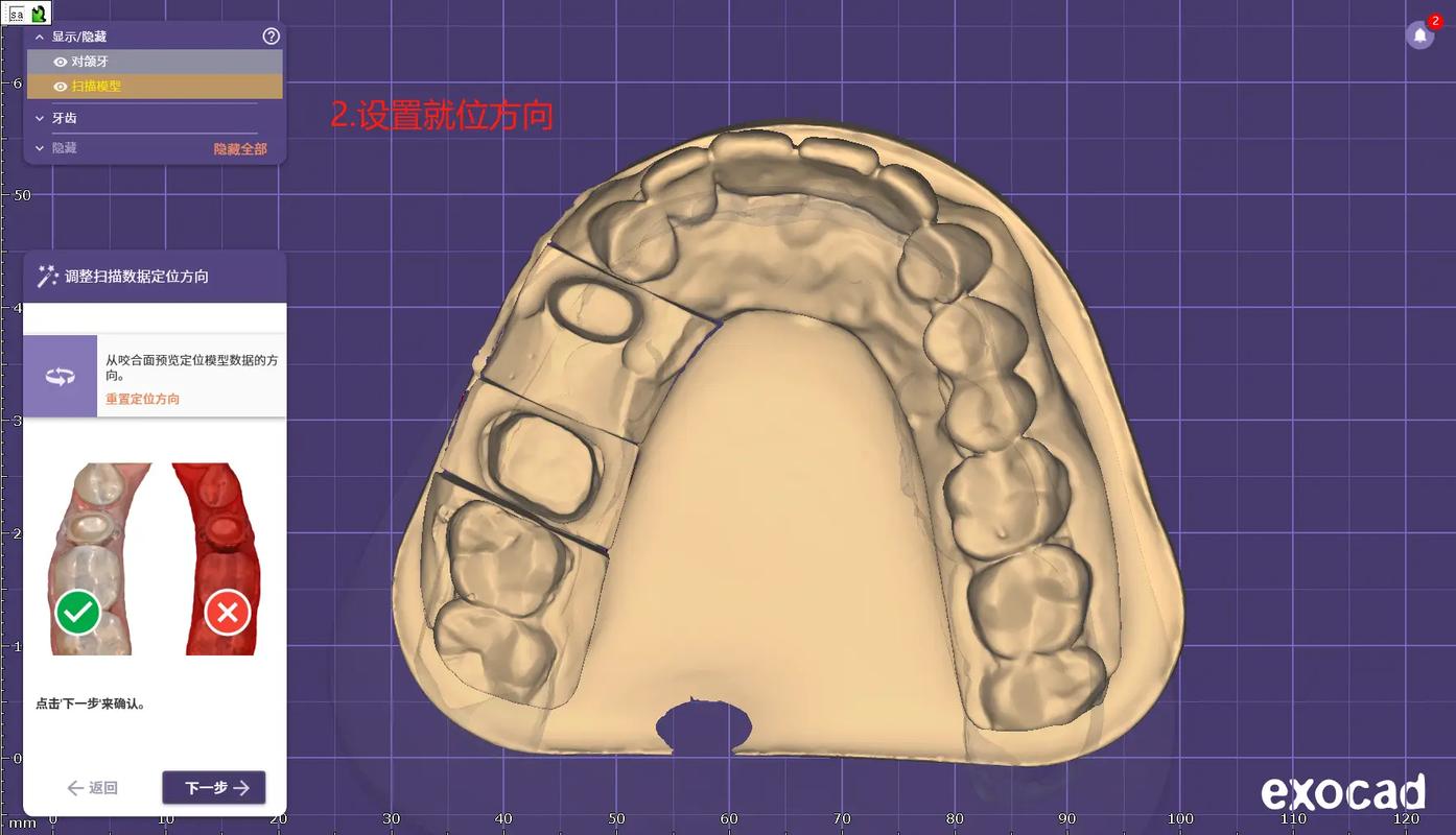 氧化锆牙齿成型有哪些关键技术方法?-图1 氧化锆牙齿成型有哪些关键技术方法?-图1