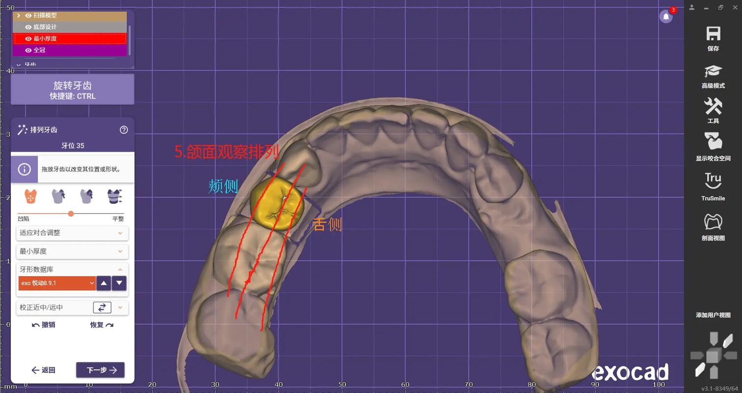 氧化锆牙齿成型有哪些关键技术方法?-图2 氧化锆牙齿成型有哪些关键技术方法?-图2