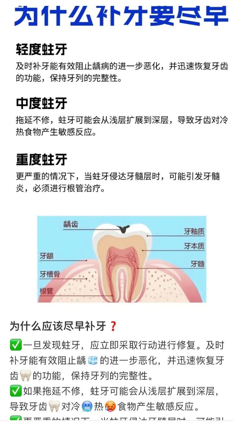 补蛀牙有几种治疗方法?-图2 补蛀牙有几种治疗方法?-图2