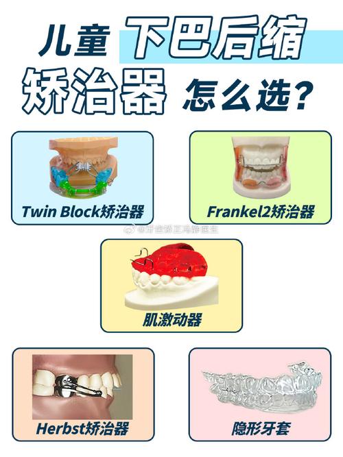 如何正确弯制上颌保持器?关键步骤与临床方法解析-图3 如何正确弯制上颌保持器?关键步骤与临床方法解析-图3