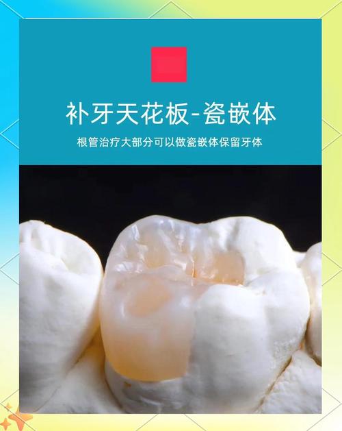 全瓷义齿内冠染色方法如何实现自然美观与持久效果?-图2 全瓷义齿内冠染色方法如何实现自然美观与持久效果?-图2