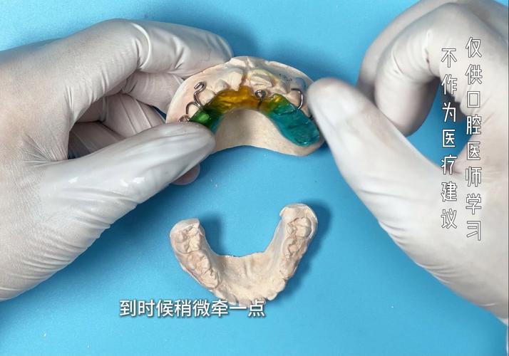 残根正畸牵引如何制作图片?-图3 残根正畸牵引如何制作图片?-图3