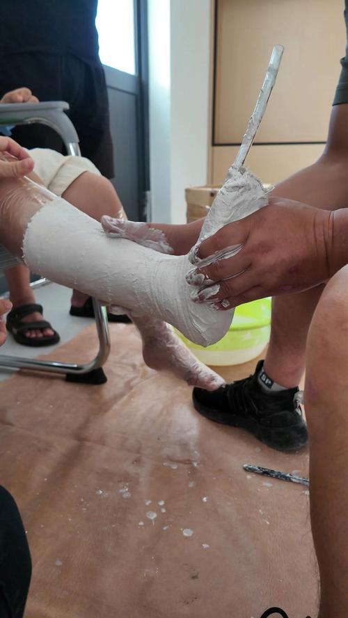 制作矫形器的流程方法-图1 制作矫形器的流程方法-图1