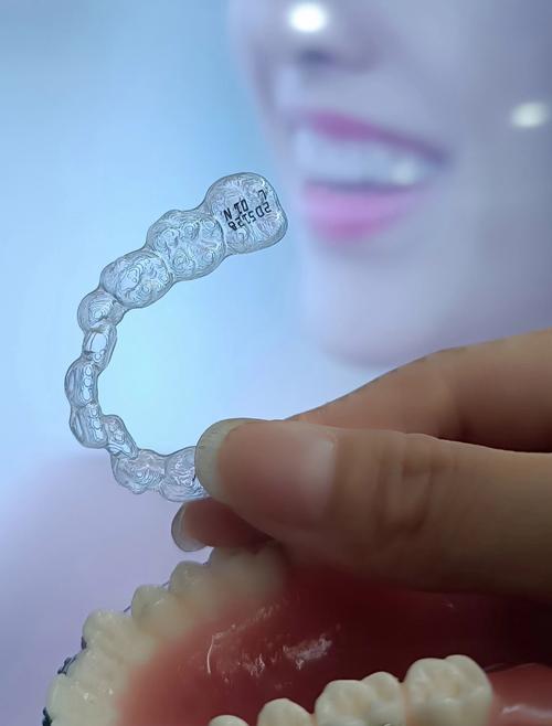 拜博口腔烤瓷牙套效果、耐用性、价格是否靠谱？适合哪些人群？-图2