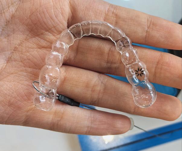 拜博口腔烤瓷牙套效果、耐用性、价格是否靠谱？适合哪些人群？-图1