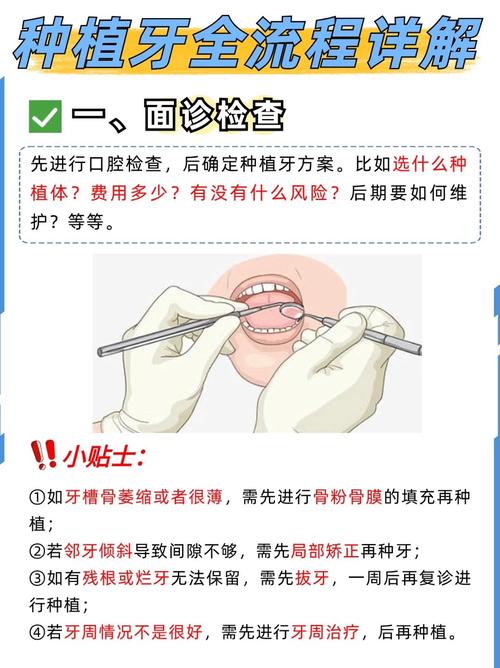 没牙根能种牙能用多久-图2 没牙根能种牙能用多久-图2