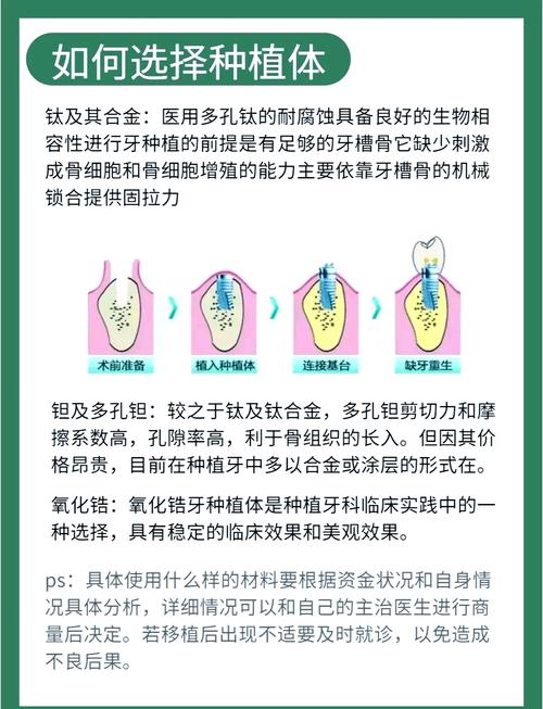拜博口腔 种植体-图3 拜博口腔 种植体-图3