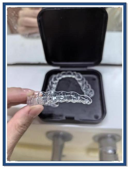 拜博口腔透明牙套矫正效果如何?舒适度、美观度和性价比怎么样?-图1 拜博口腔透明牙套矫正效果如何?舒适度、美观度和性价比怎么样?-图1