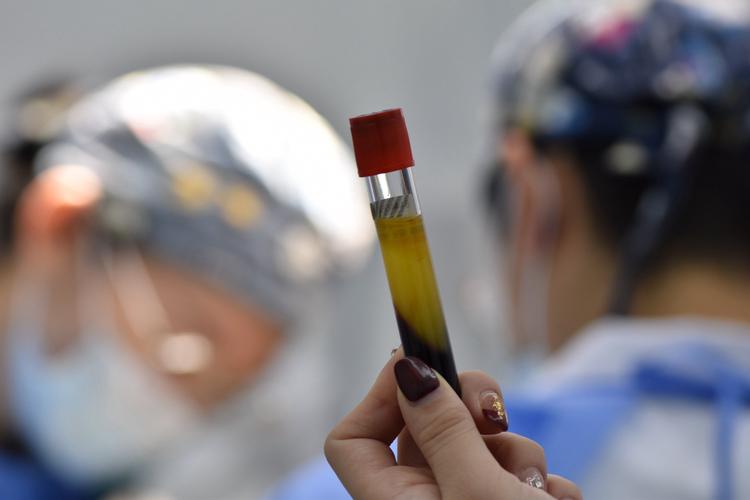 温州附属口腔医院种牙效果如何?价格贵不贵?-图1 温州附属口腔医院种牙效果如何?价格贵不贵?-图1