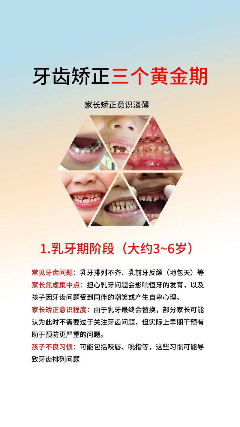 小孩牙不齐矫正何时开始?哪种方法安全有效又适合?-图1 小孩牙不齐矫正何时开始?哪种方法安全有效又适合?-图1