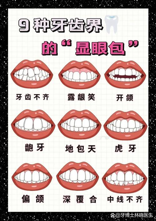 矫正牙齿有几种方法？图解不同矫正方式哪种适合？-图3