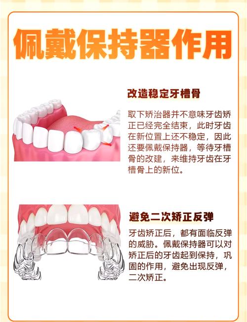 透明保持器的制作方法是怎样的？步骤与材料有哪些？-图2