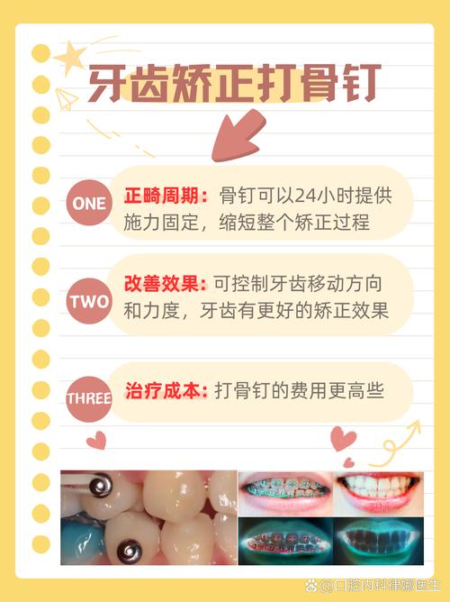 牙齿正畸 不用打钉子吧-图1 牙齿正畸 不用打钉子吧-图1