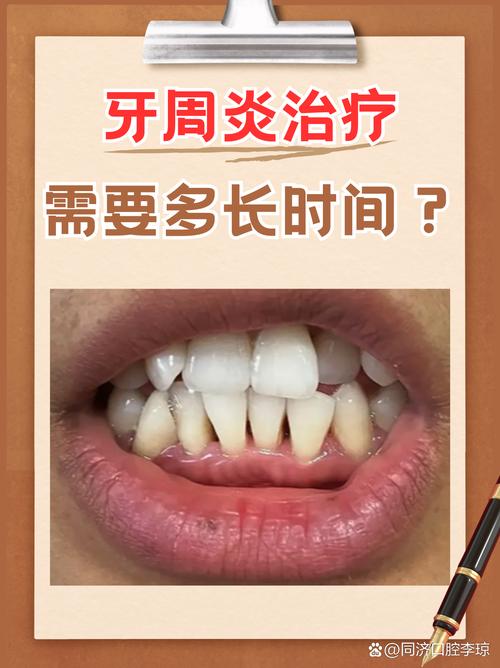 重度牙周炎能种牙吗？-图2