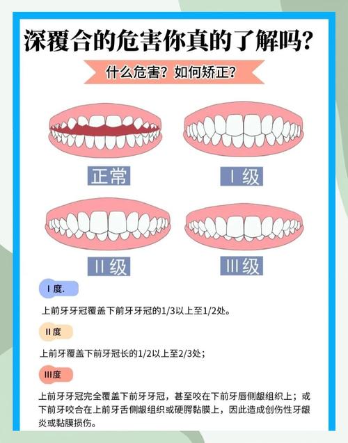 深覆合的修复治疗方法-图3