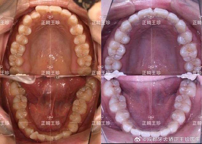 成都华美正畸怎么样?正畸查找攻略有哪些?-图1 成都华美正畸怎么样?正畸查找攻略有哪些?-图1