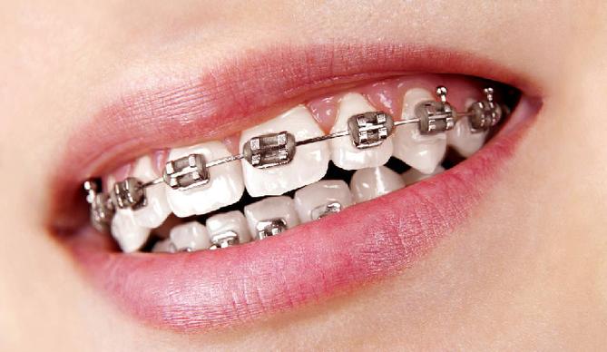 成都华美正畸怎么样?正畸查找攻略有哪些?-图2 成都华美正畸怎么样?正畸查找攻略有哪些?-图2