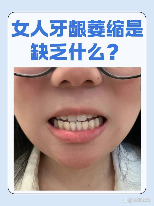 种牙能引起牙龈萎缩吗-图2