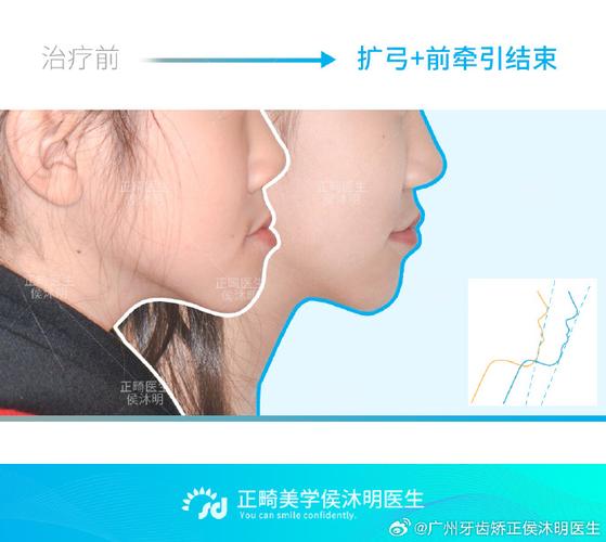 正畸颌面系统CMS系统的功能与应用是什么?-图1 正畸颌面系统CMS系统的功能与应用是什么?-图1