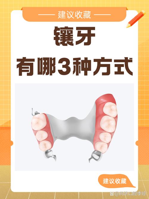 拔牙最迟什么种牙镶牙-图1