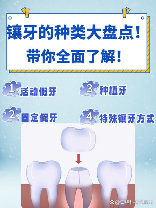 拔牙最迟什么种牙镶牙-图3