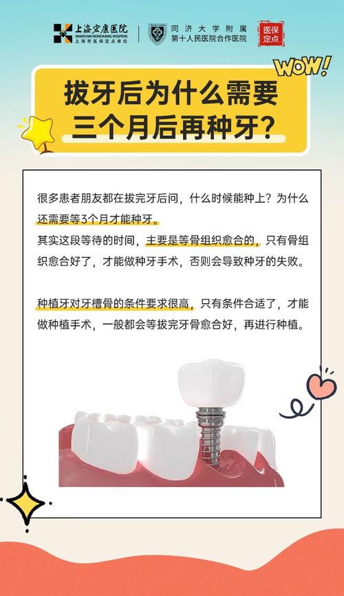 拔牙之后多久可惜种牙-图2