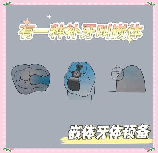 牙体预备邻面预备方法-图2