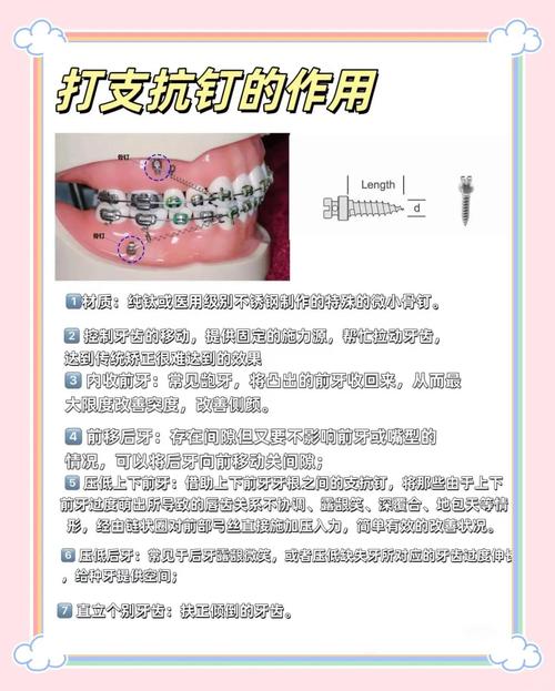 正畸bws弓的功能是什么?作用与应用解析-图1 正畸bws弓的功能是什么?作用与应用解析-图1