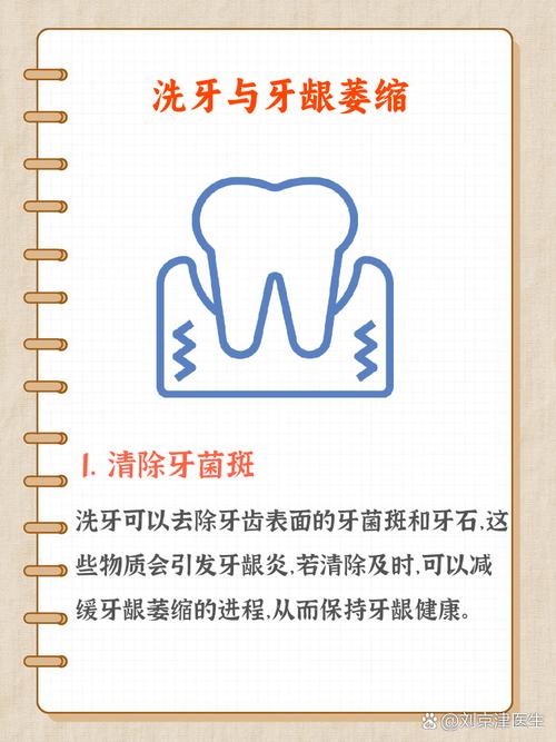 预防牙色素沉积的方法-图3