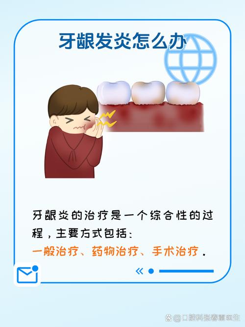 牙龈发炎如何治疗？有哪些有效方法可选？-图1