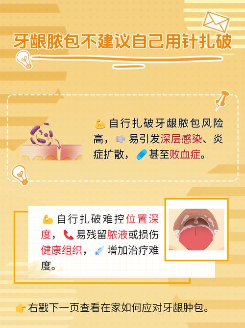 牙龈发炎如何治疗？有哪些有效方法可选？-图3