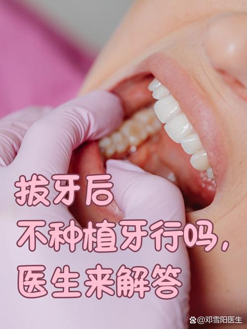 拔牙后一定要种牙吗?-图2 拔牙后一定要种牙吗?-图2