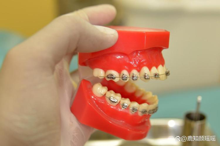 2025广州免费种牙政策真实吗?如何申请?-图3 2025广州免费种牙政策真实吗?如何申请?-图3