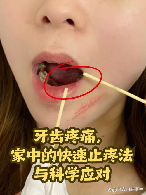 虫子牙疼剧痛难忍怎么办？如何快速止痛有妙招？-图2